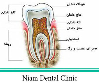 عصب کشی دندان